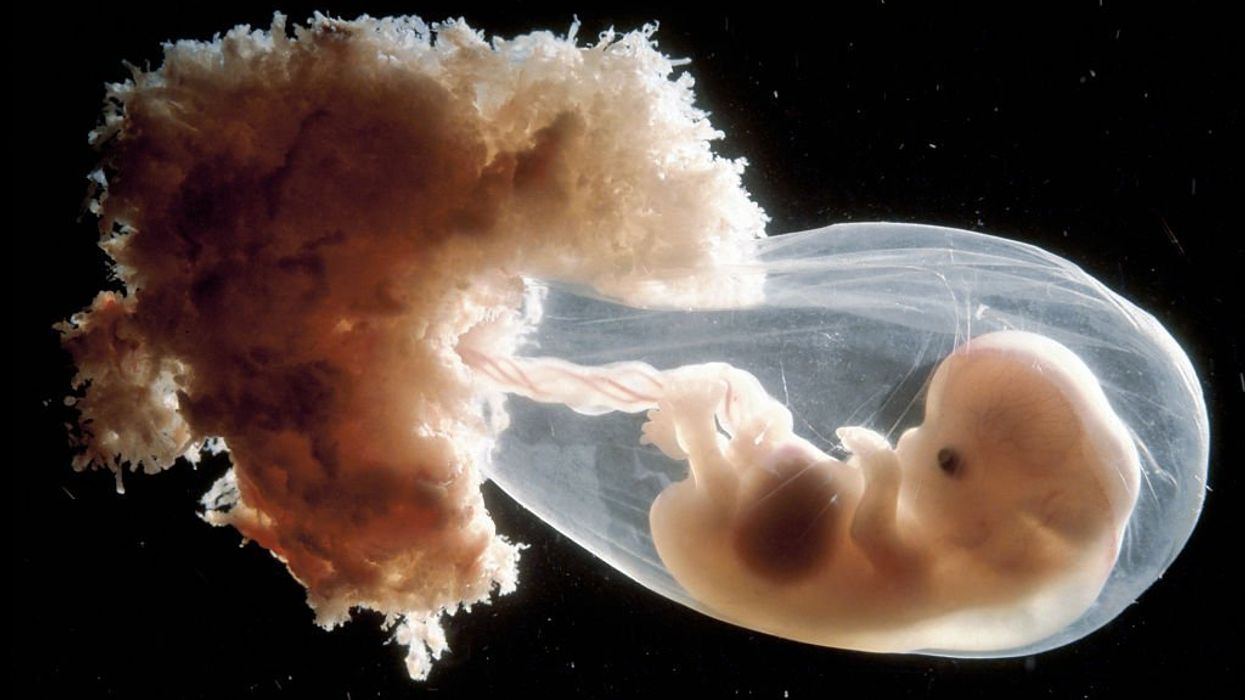 Are artificial wombs a science horror or a breakthrough? Return debates